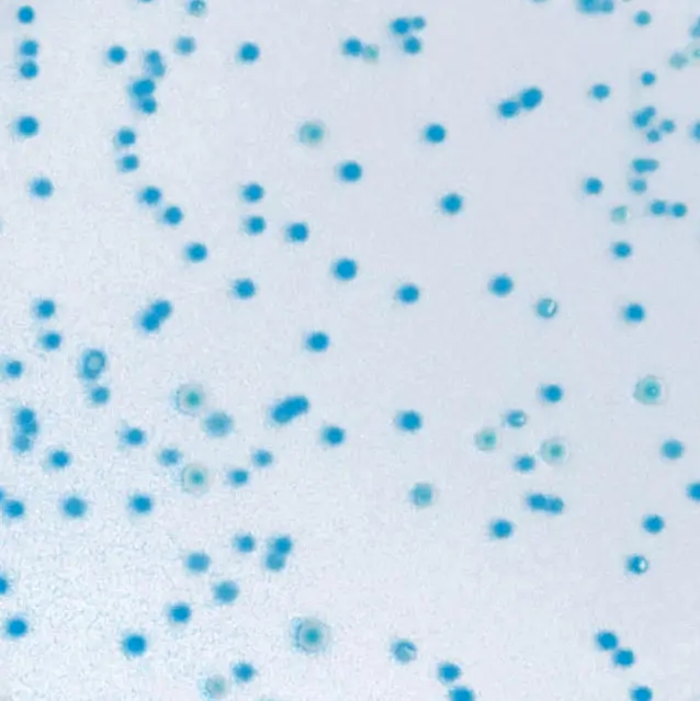 CHROMagar E.coli 1 1