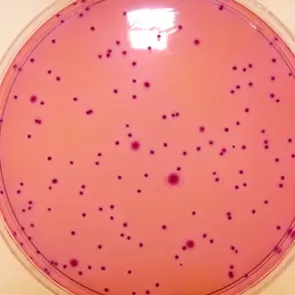 Hoa chat Violet Red Bile Glucose Agar VRBGA